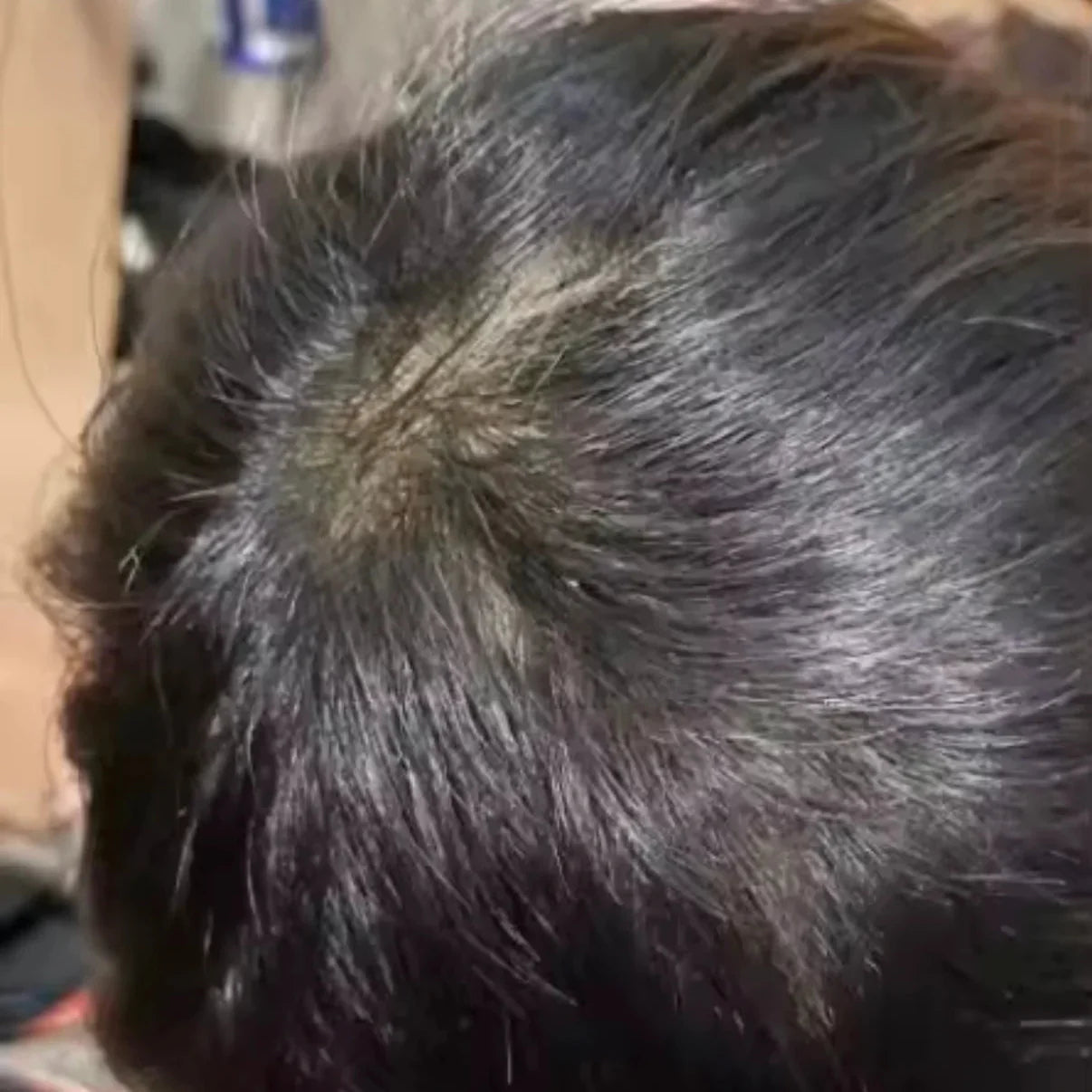 HairsKing™ – Instant Hair Density Cream