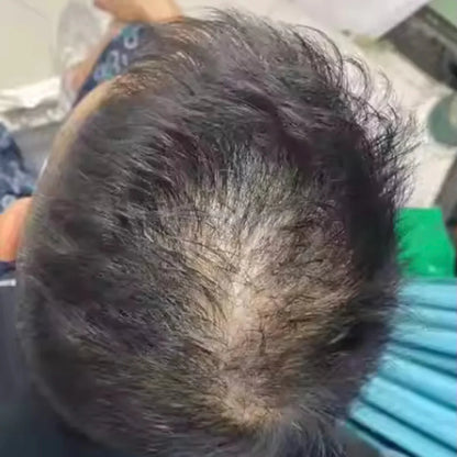 HairsKing™ – Crema Capilar Densidad Instantánea