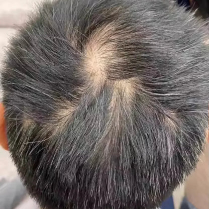 HairsKing™ – Crema Capilar Densidad Instantánea