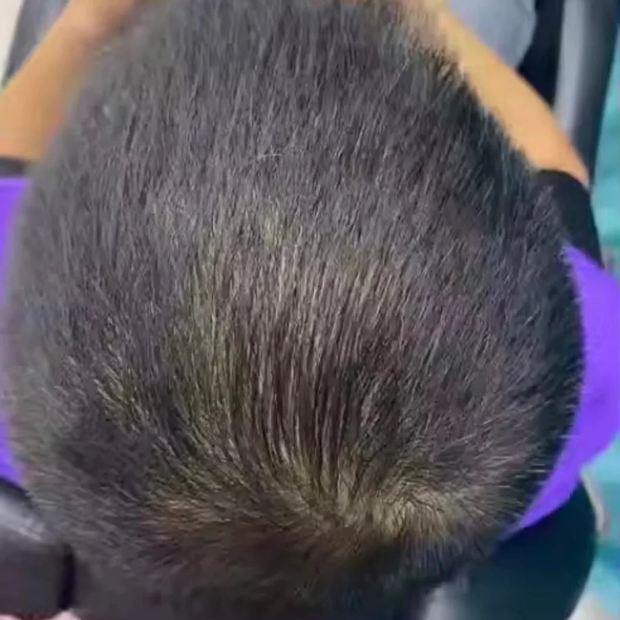 HairsKing™ – Crema Capilar Densidad Instantánea